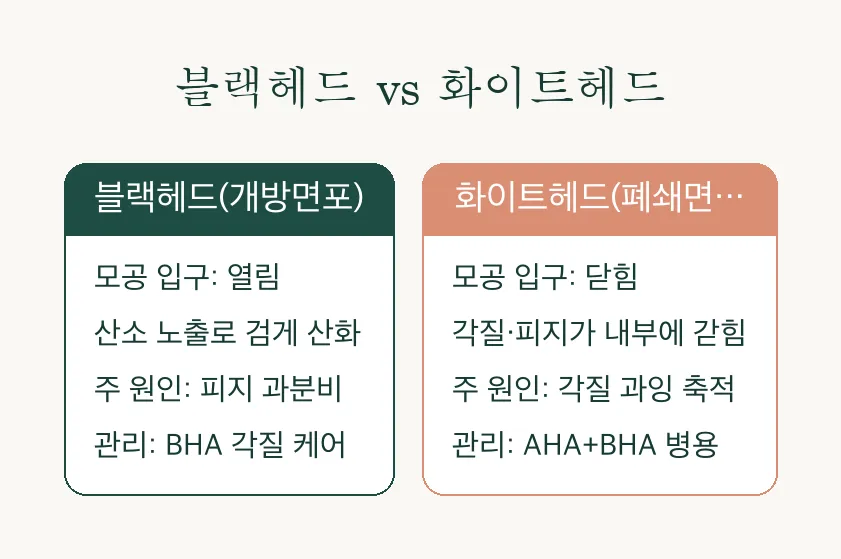 모공 줄이는 법, 피지 관리부터 병원 치료까지 알아보기 관련 이미지 4