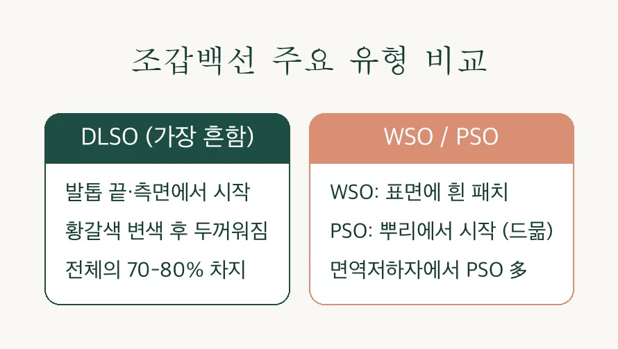 발톱무좀 조갑백선, 원인부터 치료 방법까지 알아보기 관련 이미지 3