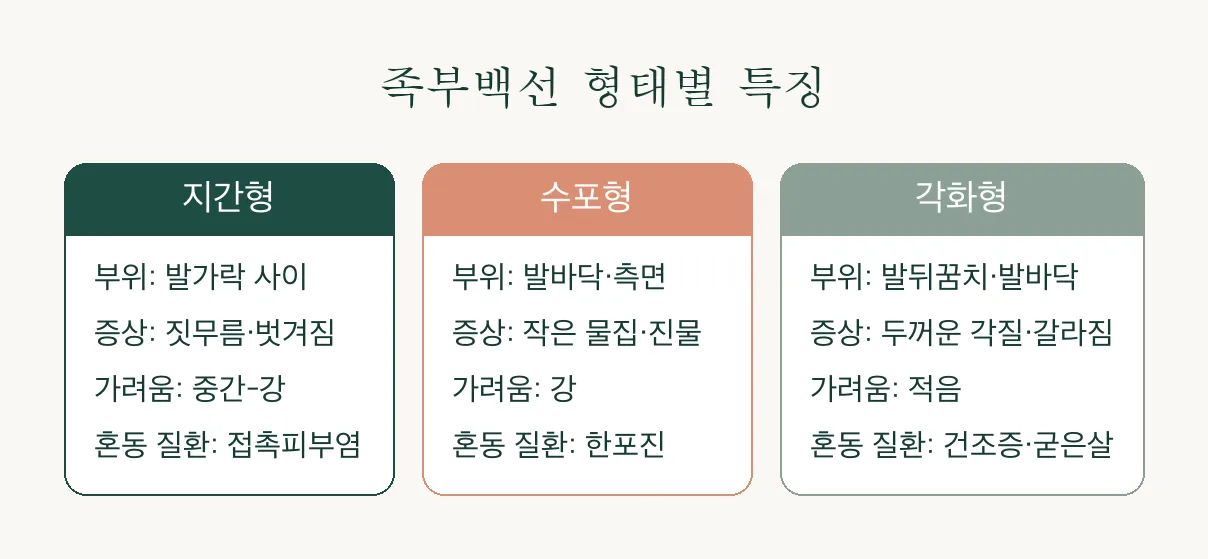 발 무좀 족부백선, 지간형부터 각화형까지 형태별로 알아보기 관련 이미지 3