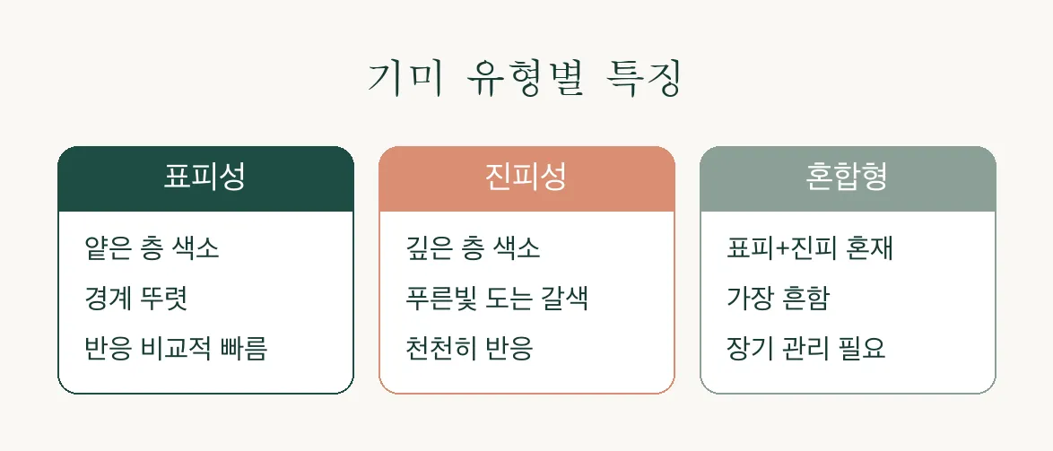 레이저 토닝, 기미 유형부터 치료 원리까지 알아보기 관련 이미지 3