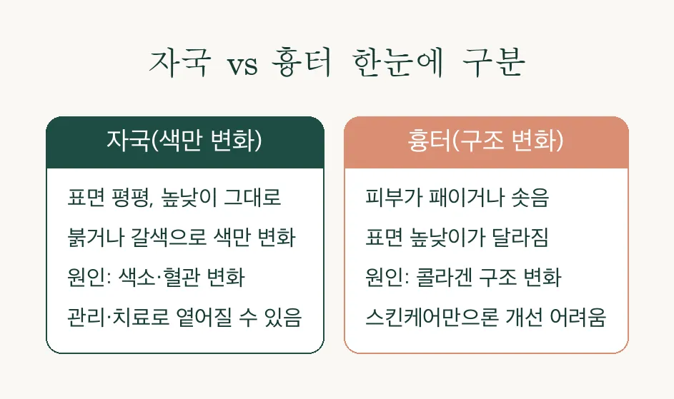 여드름 자국·흉터 구분, 관리법이 이렇게 달랐군요 관련 이미지 2