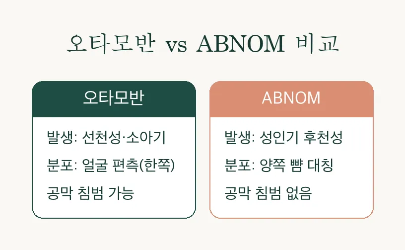 오타양모반 ABNOM, 양쪽 뺨에 대칭으로 번지는 얼룩이라면 관련 이미지 3